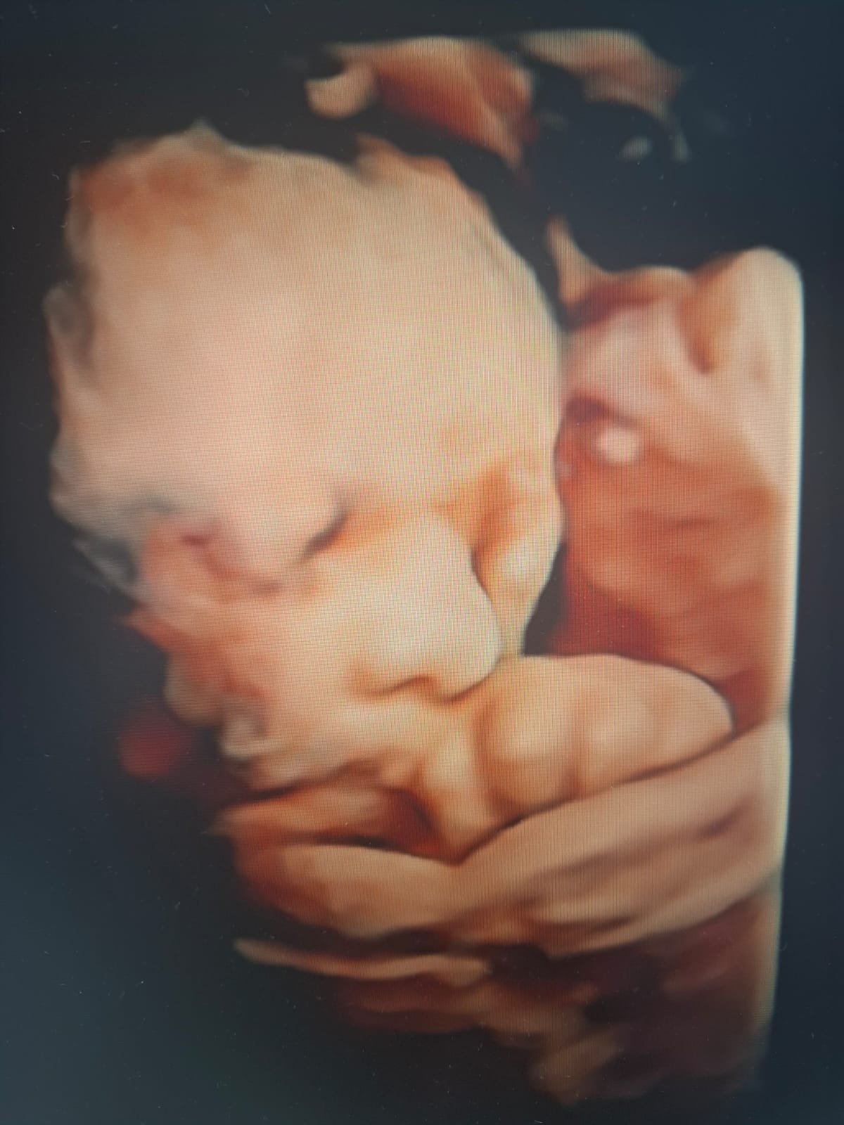 Dr. med. univ. Rovena Qerozi - Fachärztin für Gynäkologie und Geburtshilfe | Frauenarztpraxis Duisburg-Hamborn